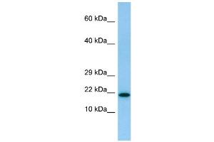 WB Suggested Anti-IL26 Antibody Titration: 1. (IL-26 Antikörper  (N-Term))