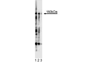 Western blot analysis for Tie2. (TEK Antikörper  (Extracellular Domain))