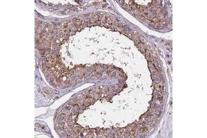 Immunohistochemical staining of human testis with FAM70B polyclonal antibody  shows moderate cytoplasmic and membranous positivity in cells of seminiferus ducts. (TMEM255B Antikörper)
