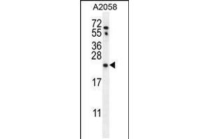 Western blot analysis in A2058 cell line lysates (35ug/lane). (RAB10 Antikörper  (AA 89-117))