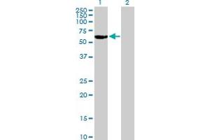 Western Blot analysis of RARG expression in transfected 293T cell line by RARG MaxPab polyclonal antibody.