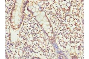 Immunohistochemistry of paraffin-embedded human small intestine tissue using ABIN7174300 at dilution of 1:100 (USP26 Antikörper  (AA 664-913))