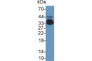 Detection of APOE in Rat Serum using Monoclonal Antibody to Apolipoprotein E (APOE) (APOE Antikörper  (AA 19-168))
