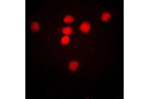 Immunofluorescent analysis of MRE11 staining in HeLa cells.