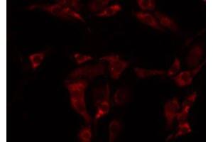 ABIN6275043 staining NIH-3T3 by IF/ICC. (GARP Antikörper  (Internal Region))