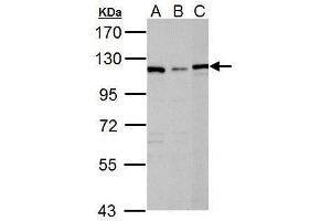 WB Image Sample (30 ug of whole cell lysate) A: Raji B: K562 C: NCI-H929 7. (DPYD Antikörper)