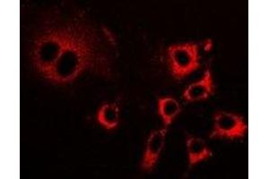 Immunofluorescent analysis of LIM staining in HepG2 cells. (PDLIM5 Antikörper)