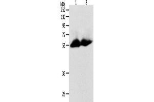 Western Blotting (WB) image for anti-Matrix Metallopeptidase 11 (Stromelysin 3) (MMP11) antibody (ABIN2431667) (MMP11 Antikörper)