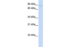 WB Suggested Anti-SLITRK6 Antibody Titration:  0. (SLITRK6 Antikörper  (N-Term))