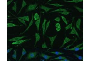 Immunofluorescence analysis of L929 cells using GAPVD1 Polyclonal Antibody at dilution of 1:100. (GAPVD1 Antikörper)