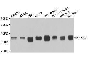 Western blot analysis of extracts of various cell lines, using PPP2CA antibody. (PPP2CA Antikörper  (AA 1-309))
