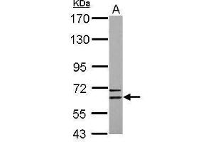 WB Image Sample (30 ug of whole cell lysate) A: U87-MG 7. (CPNE6 Antikörper)