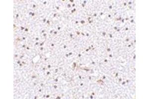 Immunohistochemistry of TOCA-1 in human brain tissue with this product at 2. (FNBP1L Antikörper  (C-Term))