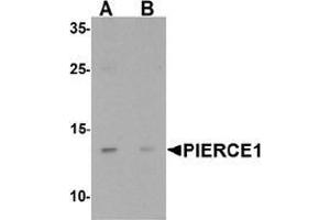 Western blot analysis of PIERCE1 in A20 cell lysate with PIERCE1 Antibody  at 1 µg/mL in (A) the absence and (B) the presence of blocking peptide. (C9ORF116 Antikörper  (N-Term))
