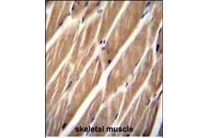 PIP5KL1 Antibody (N-term) (ABIN655244 and ABIN2844847) immunohistochemistry analysis in formalin fixed and paraffin embedded human skeletal muscle followed by peroxidase conjugation of the secondary antibody and DAB staining. (PIP5KL1 Antikörper  (N-Term))