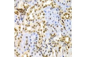 Immunohistochemistry of paraffin-embedded rat kidney using MAPK3 Antibody. (ERK1 Antikörper  (AA 1-100))