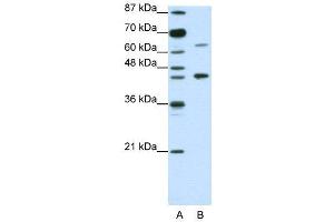 WB Suggested Anti-RARA  Antibody Titration: 1. (Retinoic Acid Receptor alpha Antikörper  (N-Term))