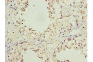 Immunohistochemistry of paraffin-embedded human testis tissue using ABIN7163973 at dilution of 1:100 (KCND1 Antikörper  (AA 410-647))