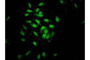 Immunofluorescence staining of Hela cells with ABIN7162487 at 1:133, counter-stained with DAPI. (SIN3B Antikörper  (AA 705-769))