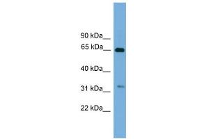 WB Suggested Anti-UBXD3 Antibody Titration: 0. (UBXN10 Antikörper  (Middle Region))