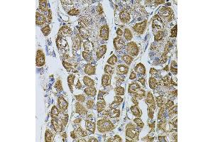 Immunohistochemistry of paraffin-embedded human stomach using UQCRC1 antibody (ABIN5971722) at dilution of 1/100 (40x lens). (UQCRC1 Antikörper)