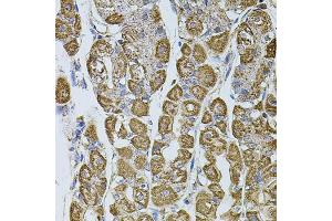 Immunohistochemistry of paraffin-embedded human stomach using UQCRC1 antibody (ABIN5971722) at dilution of 1/100 (40x lens).