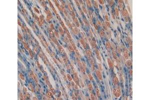 Used in DAB staining on fromalin fixed paraffin- embedded stomach tissue (Chemerin Antikörper  (AA 21-155))
