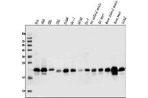 Western blot analysis of Caveolin-2/CAV2 using anti-Caveolin-2/CAV2 antibody (ABIN7601170).