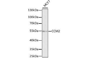CCM2 抗体  (AA 1-300)
