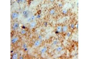 Used in DAB staining on fromalin fixed paraffin-embedded Brain tissue (Neurotrypsin Antikörper  (AA 153-399))
