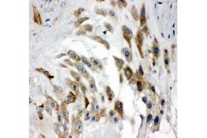 IHC analysis of Noggin using anti-Noggin antibody (ABIN5519047).