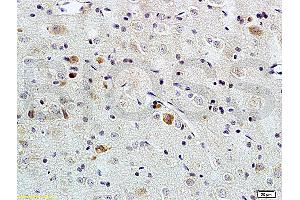Formalin-fixed and paraffin embedded rat brain tissue labeled with Rabbit Anti-PACAP-38 Polyclonal Antibody (ABIN726215), Unconjugated at 1:200 followed by conjugation to the secondary antibody and DAB staining. (PACAP-38 Antikörper  (AA 31-38))