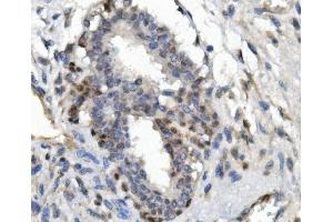 IHC analysis of FOXP1 using anti-FOXP1 antibody (ABIN7602780). (FOXP1 Antikörper  (C-Term))