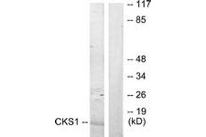 Western Blotting (WB) image for anti-CDC28 Protein Kinase Regulatory Subunit 1B (CKS1B) (AA 10-59) antibody (ABIN2889528)
