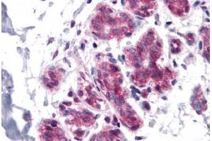 Human Breast: Formalin-Fixed, Paraffin-Embedded (FFPE) (CDC27 Antikörper  (C-Term))