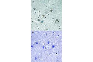 Immunohistochemical staining of human brain tissue by DPYSL2 (phospho T509) polyclonal antibody  without blocking peptide (A) or preincubated with blocking peptide (B) under 1:50-1:100 dilution. (DPYSL2 Antikörper  (pThr509))