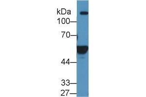 Western blot analysis of Human K562 cell lysate, using Human ALDH1A2 Antibody (1 µg/ml) and HRP-conjugated Goat Anti-Rabbit antibody (