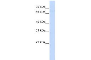 WB Suggested Anti-ABCB8 Antibody Titration:  0. (ABCB8 Antikörper  (Middle Region))