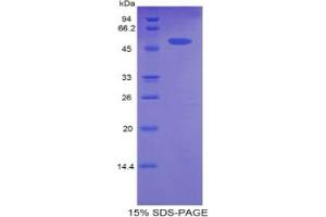 SDS-PAGE analysis of Rat CPT1A Protein. (CPT1A Protein)