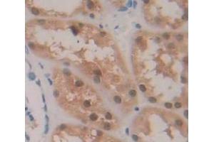 Used in DAB staining on fromalin fixed paraffin- embedded Kidney tissue (HIPK2 Antikörper  (AA 977-1198))