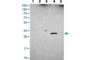 Western blot analysis of Lane 1: RT-4, Lane 2: U-251 MG, Lane 3: Human Plasma, Lane 4: Liver, Lane 5: Tonsil with UTP23 polyclonal antibody  at 1:250-1:500 dilution.