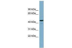 CANT1 antibody used at 1 ug/ml to detect target protein. (CANT1 Antikörper  (Middle Region))