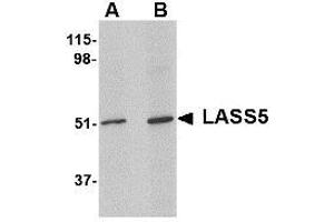 Image no. 1 for anti-LAG1 Homolog, Ceramide Synthase 5 (LASS5) (N-Term) antibody (ABIN341704)