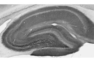 Adult rat hippocampus immunohistochemistry.