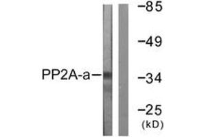 Western blot analysis of extracts from A549 cells, using PP2A-alpha (Ab-307) Antibody.