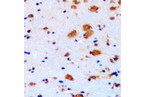Immunohistochemical analysis of p27 Kip1 staining in human brain formalin fixed paraffin embedded tissue section. (CDKN1B Antikörper  (C-Term))