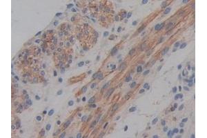 Immunohistochemistry (IHC) image for anti-ATP-Binding Cassette, Sub-Family A (ABC1), Member 1 (ABCA1) (AA 1404-1663) antibody (ABIN7433312)
