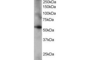 Western Blotting (WB) image for anti-Coronin, Actin Binding Protein, 1C (CORO1C) (C-Term) antibody (ABIN2465550) (CORO1C Antikörper  (C-Term))