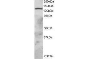 Image no. 1 for anti-Ring Finger Protein 31 (RNF31) (C-Term) antibody (ABIN374257) (RNF31 Antikörper  (C-Term))