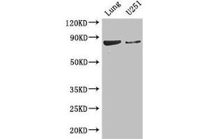 Western Blot Positive WB detected in: Mouse lung tissue, U251 whole cell lysate All lanes: YTHDC1 antibody at 3. (YTHDC1 Antikörper  (AA 89-153))